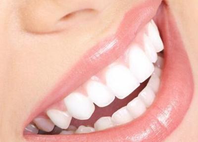 你知道牙齿美白有什么小妙招吗？