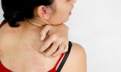 皮肤经常瘙痒是什么原因